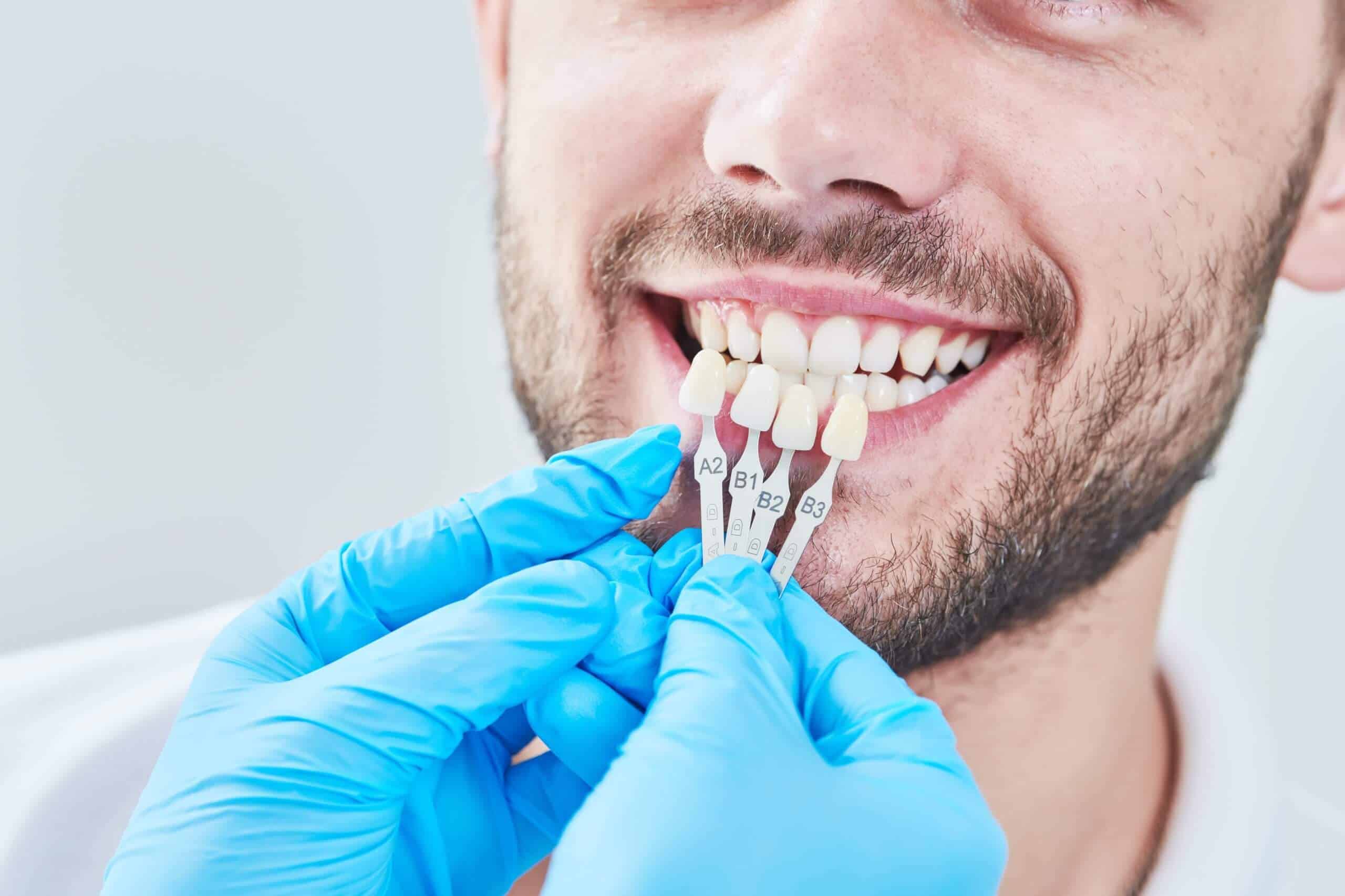 Dental Makeover | Access Oral Surgery | Sangaree & Mt. Pleasant, SC