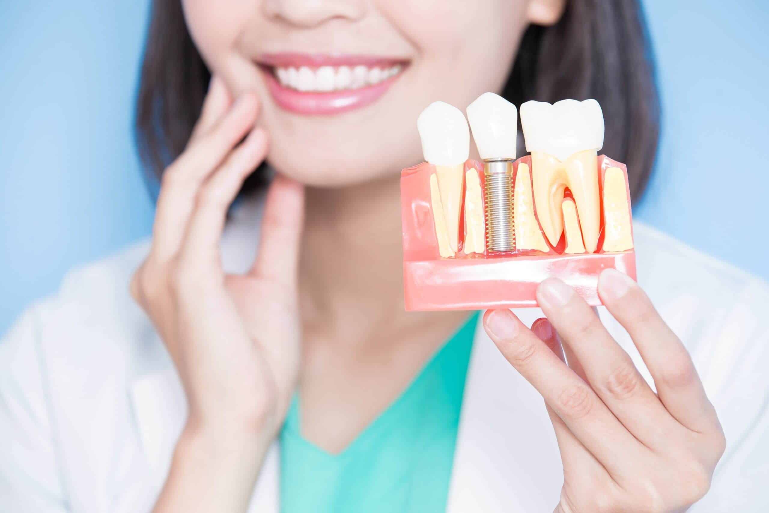 Step-by-Step Process of Getting Dental Implants What to Expect