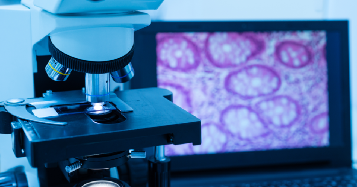 Oral Biopsies treatment in Summerville, SC